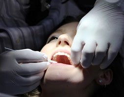 San Diego California dental hygienist removing plaque from teeth of female patient